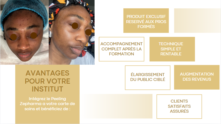 👩🏾‍🎓👨🏻‍🎓Formation en Peeling éclair ZEPHARMA – Maîtrisez une Technique Naturelle et Efficace ! 🌿✨